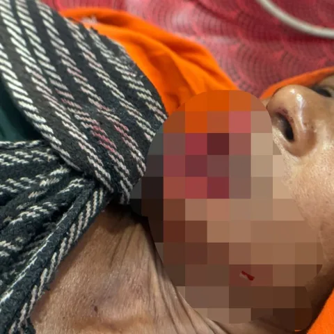 भैंस ढूंढने गए 2 लोगों पर भालू ने किया हमला:1 की हालत गंभीर, उदयपुर किया रेफर, परिजन ले गए पालनपुर